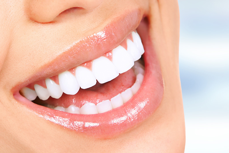 Cosmetic Dentist in Taunton